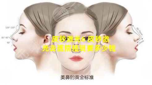皮秒激光6 皮秒激光去医院祛斑要多少钱